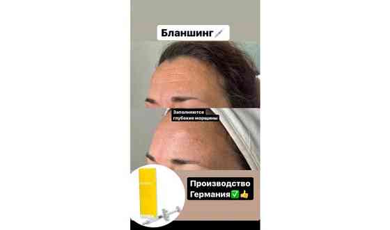 Косметология иньекционная и аппаратная. чистка лица. лечение     
      Астана, Кургальжинское шоссе Астана