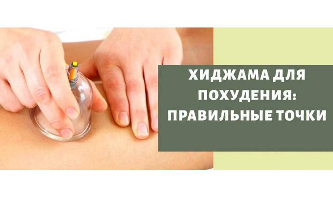 Hijama for the whole body Taraz - photo 1