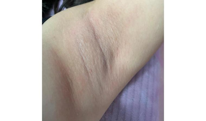 Depilation using sugaring and waxing methods Rudnyy - photo 3